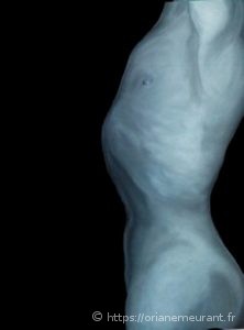 A part of Mapplethorpe